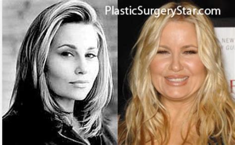 jennifer coolidge before surgery|Comedian Jennifer Coolidge explains Hollywood。